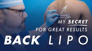 My Secret for Great Results - Back Liposuction