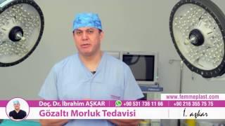 Gözaltı Morlukları Tedavisi - Doç. Dr. İbrahim Aşkar