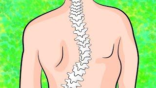 How to get rid of upper back scoliosis in 4 minutes a day