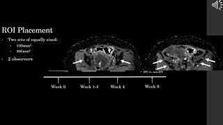 Jose Perucho - Intravoxel Incoherent Motion MRI Assessment of Chemoradiation Induced Changes