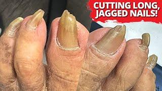 1 Year Without Cutting! Extreme Thick Nail & Callus Trimming