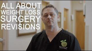 All About Weight Loss Surgery Revisions