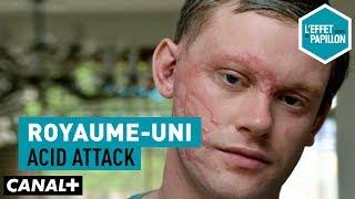 Royaume-Uni : Acid attack - L'Effet Papillon