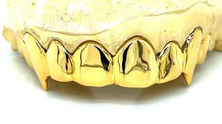 10k grillz vs 14k grillz by Seattle Gold Grills.  #GoSeeFRED