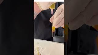 Drawing up Plasma for PRP Injections