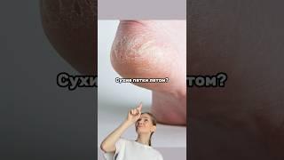 СУХИЕ ПЯТКИ?Появляются ТРЕЩИНКИ? Попробуй этот крем для ногWb: 124736678 #крем #ноги #заботаосебе