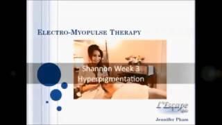 Jennifer Pham for The Skin Games Week 3- Hyperpigmentation