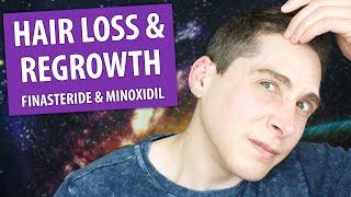 Hair Loss on T & How I'm Regrowing It