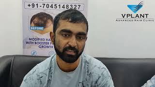 A Happy Client | Testimonial | Vplant Hair Transplant Clinic