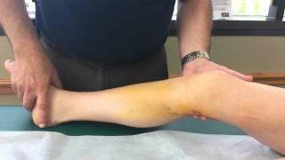 Quiz #1, Video #2 The case of the damaged knee