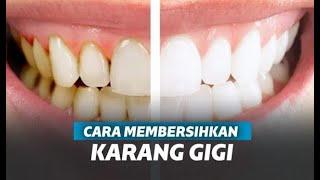 cara membersihkan karang gigi dengan bahan dapur mudah banget