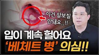 입병, 구내염 자주 생긴다면 ‘베체트 병’ 일수 있습니다! 입이 계속 헐어요