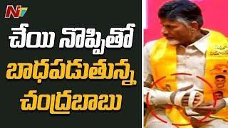 TDP Chief Nara Chandrababu Naidu Suffers From Hand Pain || NTV