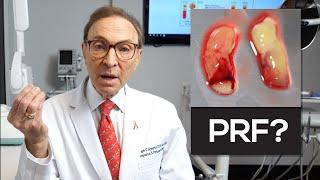 How We Use Your Own Blood To Make PRF | Platelet Rich Fibrin