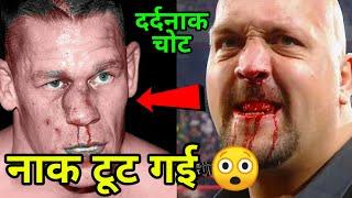 10 WWE Wrestlers Who Got Their Nose Broken in WWE (For REAL) ! Seth Rollins Break John Cena Nose !