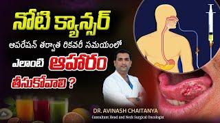 FOOD for MOUTH CANCER patients | Dr.Avinash Chaitanya | Kaizen Hematology Oncology Network