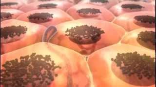 From Melanocyte to Melanoma