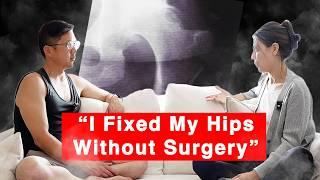 Hip Pain from Hip Dysplasia and Hip Labrum Tear - How She Recovered!