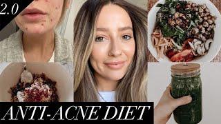 Anti-acne diet | Foods that cleared my skin!