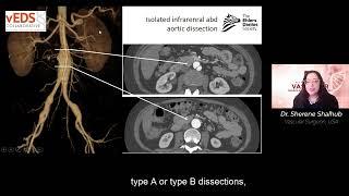 2021 The Aorta and Iliac Arteries Pathology in vEDS  - Dr. Sherene Shalhub