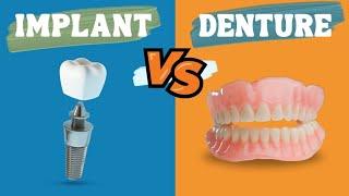 Dental Implants vs Dentures | Are Dental Implants better than Dentures?  OrthoSquare