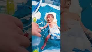 dead BabyBweight 900gram#newbornbaby #pulsehospital #pediatrics #subscribe