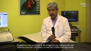 Ictus y Neurología Preventiva (Centro Neurológico Antonio Alayón)