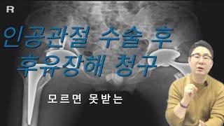 인공관절수술 하셨나요? 그럼 후유장해보험금 받으셔야죠! #인공관절 #상해후유장해 #질병후유장해