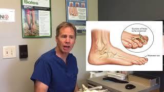 Capsulitis (Inflammation of Second Metatarsal) -- Information, Treatment Options