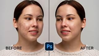 Ai Remove Tool || High end Skin in Photoshop Beta