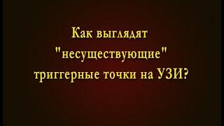 Как выглядят "несуществующие"триггерные точки на УЗИ?