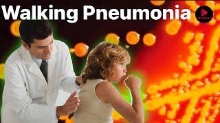 Walking pneumonia are surging in kids this year