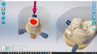 MillBox: Introduction to Dental CAM Software