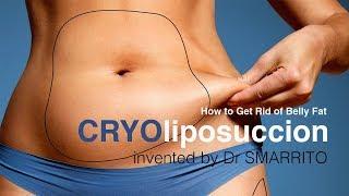 CRYOLIPOSUCCION : nouvelle liposuccion. The NEW LIPOSUCTION : The best way to get ride of Belly Fat.