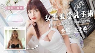 年輕女孩透過女王波隆乳手術讓自己胸型變飽滿心得分享 ~