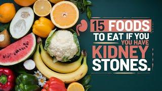 15 Foods To Eat If You Have Kidney Stones || Diet For Kidney Stones