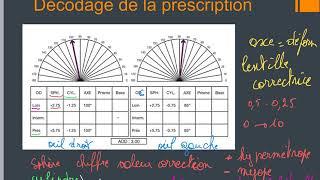 Prescription ophtalmique