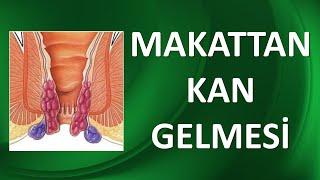 MAKATTAN KAN GELMESİ