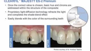 Clearfil Majesty ES 2 Premium