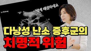 [둘째언니 Dr.구] 배란이 안 되면 임신도 어렵다? 다낭성 난소 증후군 해결법!
