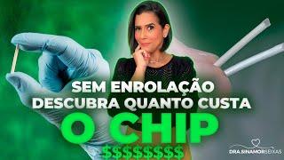 SINAMOR - QUANTO CUSTA UM CHIP HORMONAL?