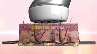 Infusion Аппараты для косметологии и физиотерапии | Создание 3D графики