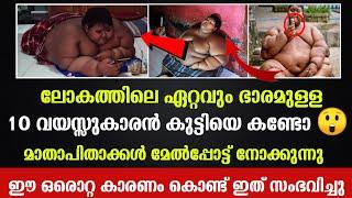 ലോകത്തിലെ ഏറ്റവും വലിയ ഭാരമുള്ള കുട്ടിയെ നോക്കൂ. അൽഭുത പ്പെട്ട്‌ ലോകം /Bukhara Media