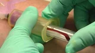 Venipuncture