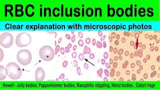 Inclusion bodies - red blood cell inclusions bodies|details|microscopic photos