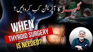 Disease of thyroid Gland: When we need surgery? | Prof De Javed Iqbal |