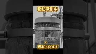 脂肪吸引を検討されている方はしっかり変化を出しますのでぜひ岩本にお任せください。#太もも脂肪吸引  #太もも痩せ #太もも痩せたい #富山　#高岡