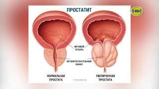 ЛДЦ «Медицина» диагностика  и лечение простатита   – выпуск №17 2017 г