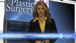 Lid Differences Can Affect Asian Eye Surgery