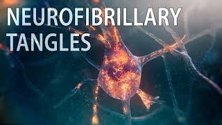 Tau & neurofibrillary tangles animation | Alzheimer’s disease | medical animation